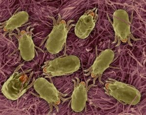 Dust mites under a microscope